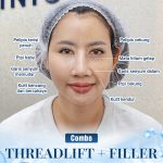 Jika Anda ingin tampil cantik dan meremajakan kulit secara menyeluruh, Anda harus mencoba kombin