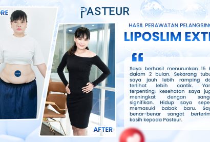 Feedback klien setelah perawatan Liposlim Extra di Pasteur Clinic dengan hasil pengurangan lemak tubuh terlihat lebih ramping